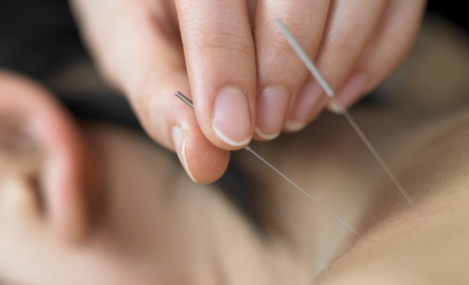 acupuncture for cancer patients