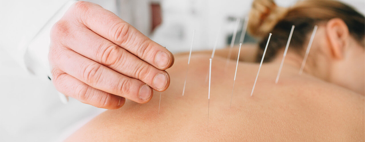 regular acupuncture treatments
